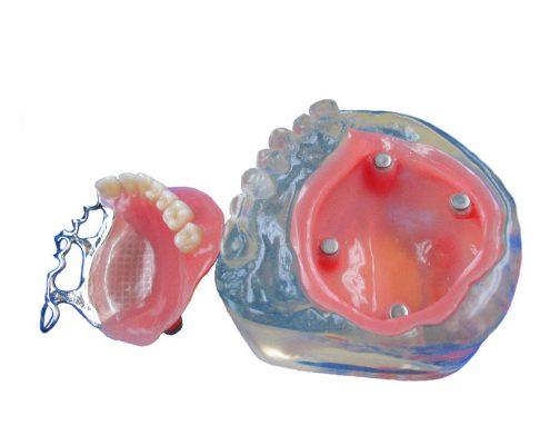 Obturator magnetisch gekoppelt