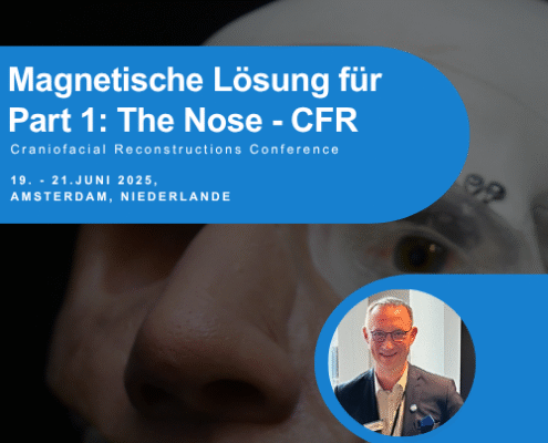 Steco prästentiert Titanmagnetics auf der Craniofacial Conference Part 1 The Nose